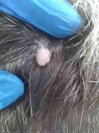 Внутридермальный меланоцитарный невус