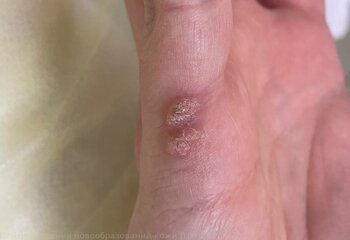 Ребро ладони