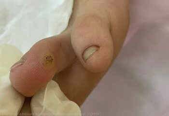 Палец стопы